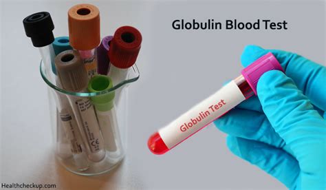 Globulin Blood Test: What It Is, Procedure, Results .
